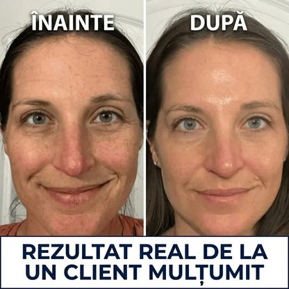Cremă coreeană anti-rid pentru femei